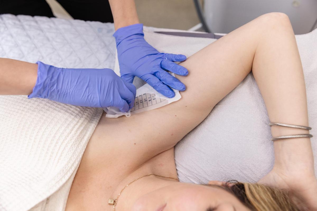 Is Miradrya Permanent Sweat Reduction Solution? by fatimadynamic