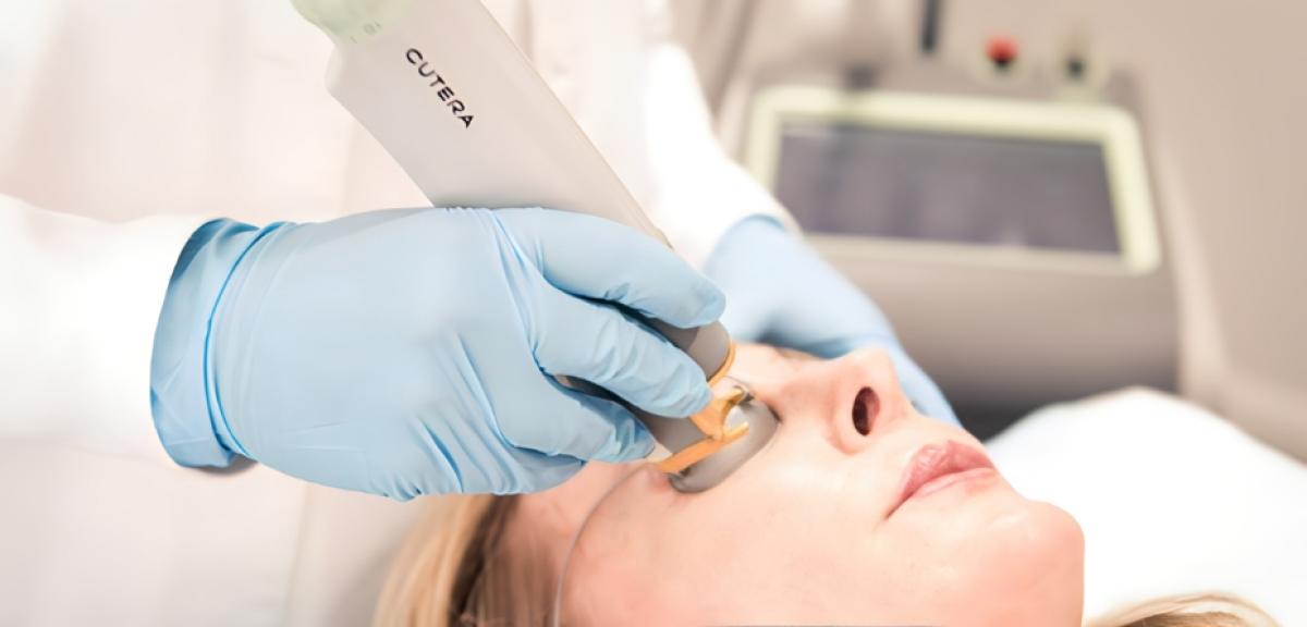 Does Fotona 4D For Face Reduce Fine Lines? Does Fotona 4D For Face Reduce Fine Lines? by MuhammadAhmad