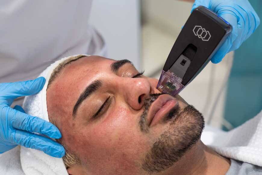 Can Morpheus8 Treatment Effectively Minimize Large Pores? Can Morpheus8 Treatment Effectively Minimize Large Pores? by aestheticclinicdubai6@gmail.com