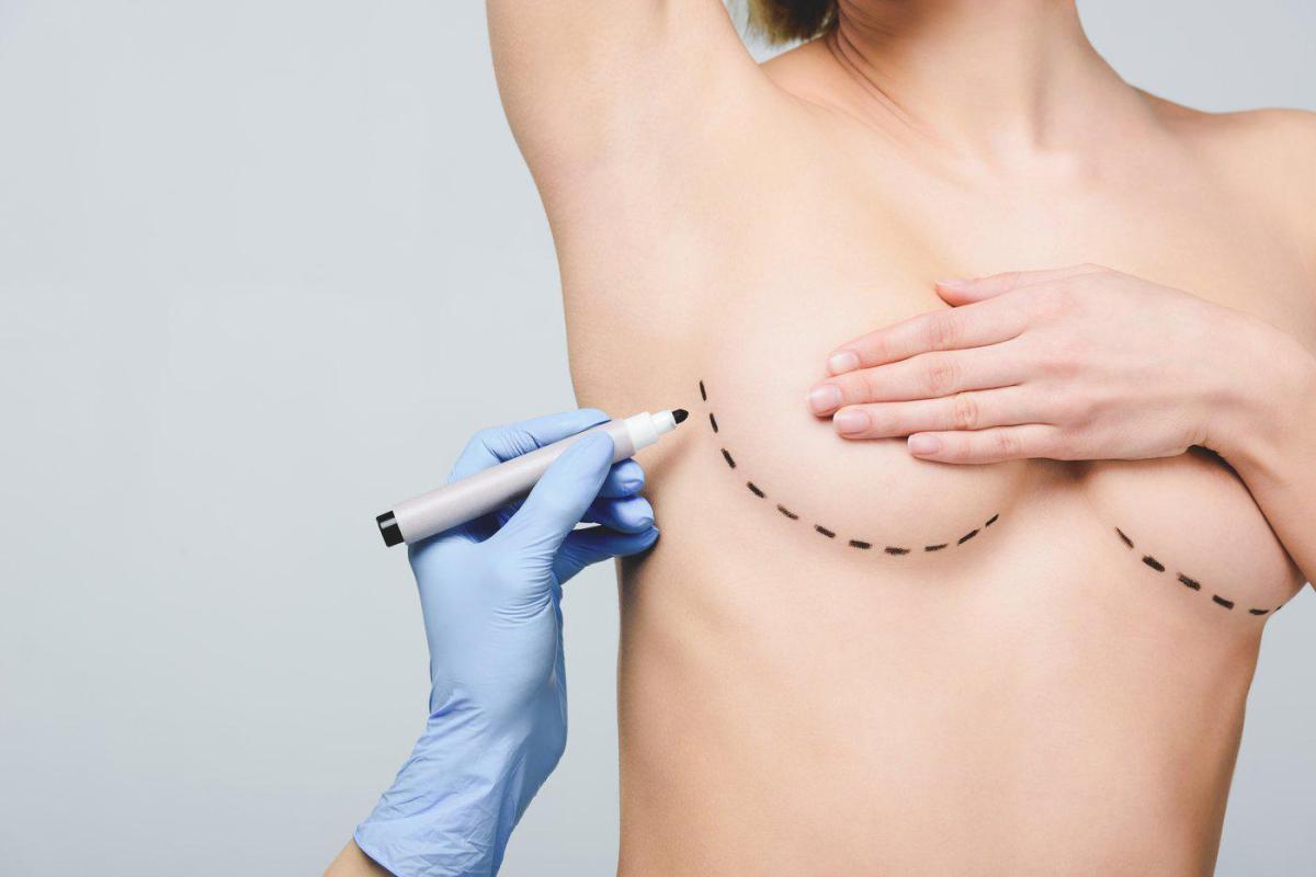 What Is Areola Reduction Surgery And How It Works? by Dynamicclinic12