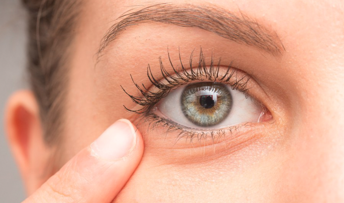 Do Under Eye Fillers Improve The Face? by dynamicaesthetic