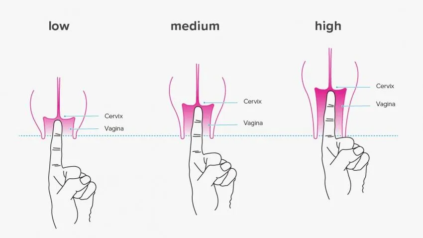 Finding your cervix