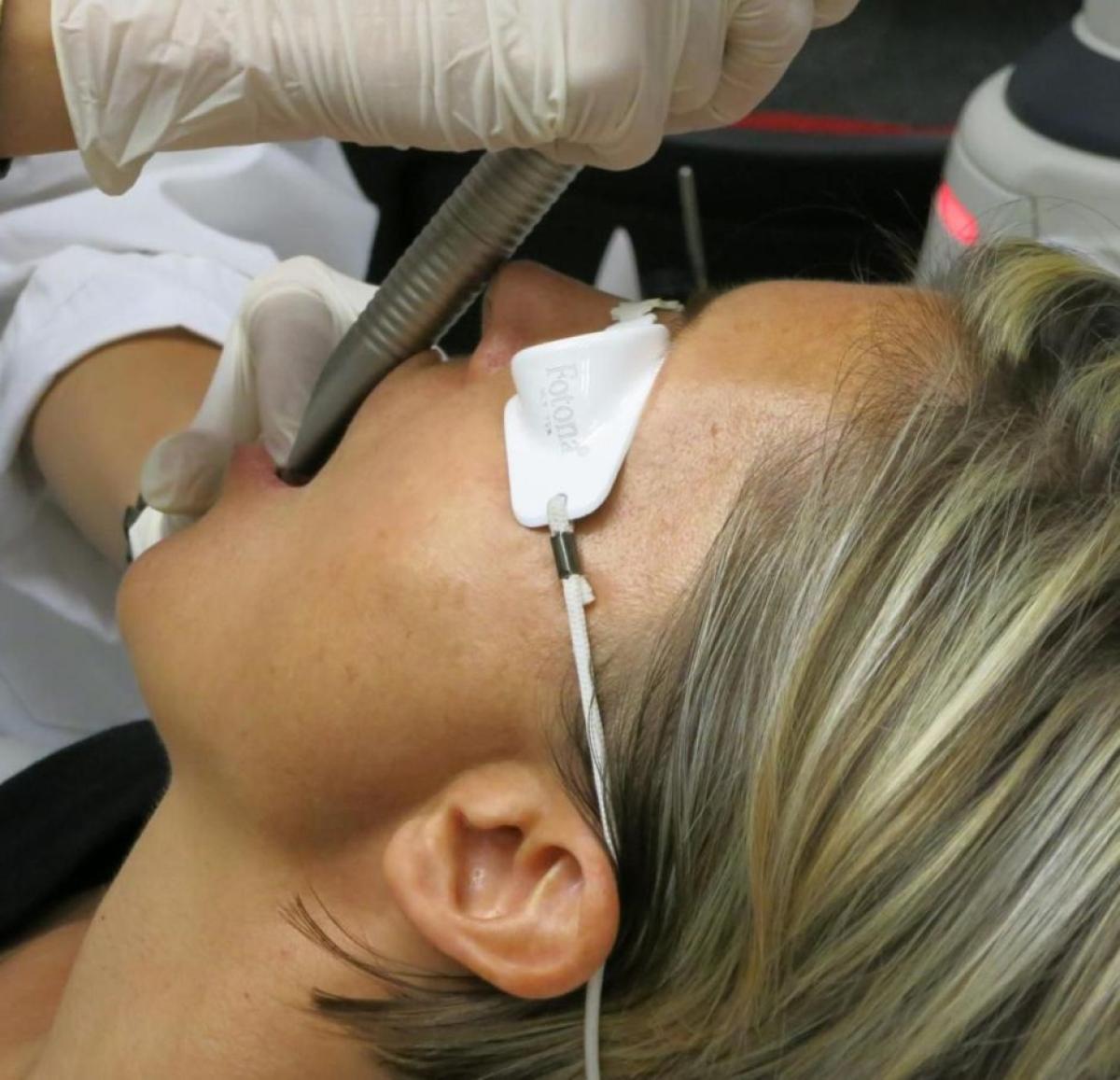 Does Fotona 4D For Facelift Address Tissue Tone? by Taimoor Tahir