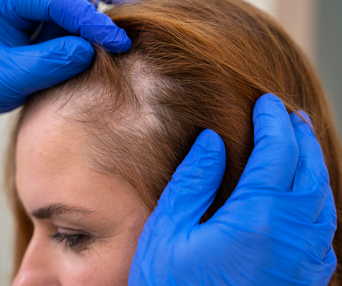 Hair Transplant In Dubai That Restores Natural Hair Growth And Confidence by healthcareblog