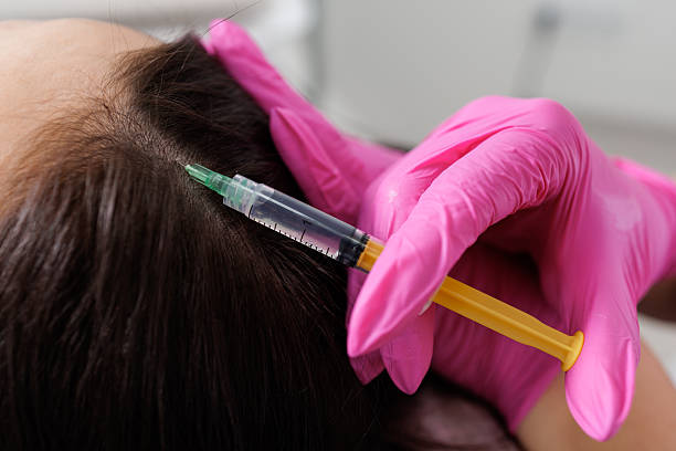 Does The Best PRP Hair Treatment Strengthen Roots? by Enfieldabudhabi
