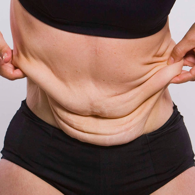 Is Bariatric Surgery Recommended For Diabetes? by MuhammadAhmad