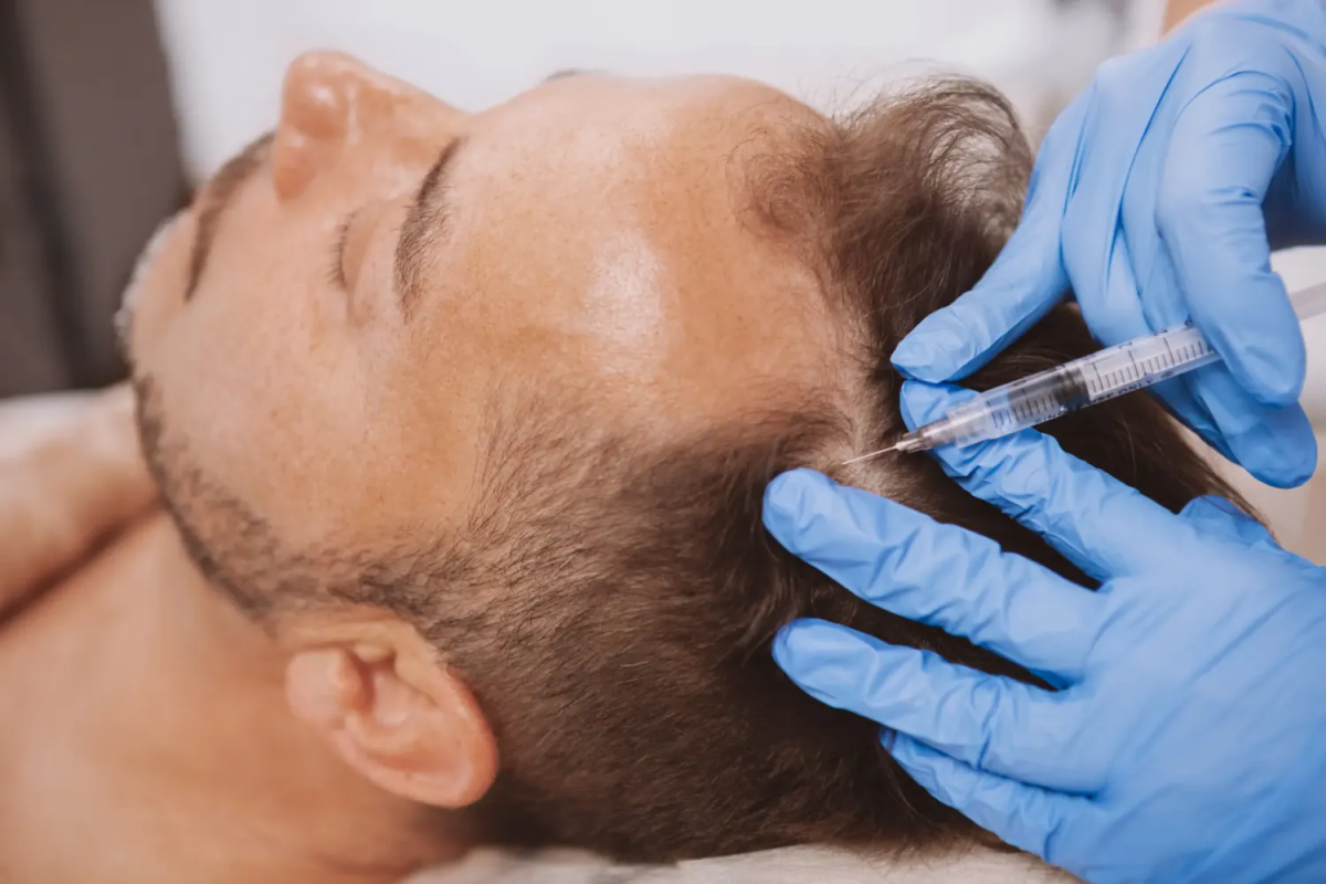 How Does Best PRP Hair Treatment Promote Growth? How Does Best PRP Hair Treatment Promote Growth? by eirhakhan