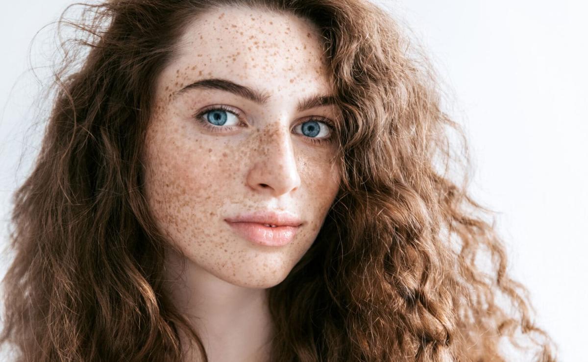 Is Freckles And Blemishes Treatment Safe For Skin? by fatimadynamic