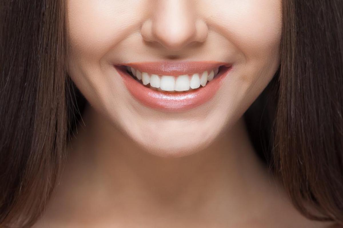 What Is The Typical Cost Of Hollywood Smile Design? by cdynmic