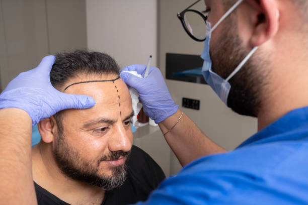 DHI Hair Transplant In Riyadh: The Latest Innovation In Hair Restoration by Royal Clinic Saudia