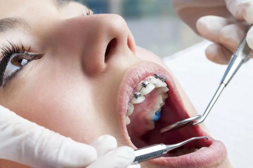 problems with braces  visit orthodontist for braces