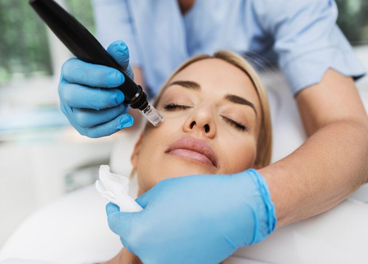 Is Microneedling A Good Option For Individuals With Oily Skin? by dynamicaesthetic