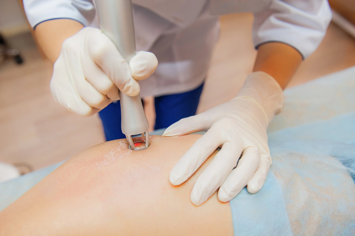 Transform Marks Into Radiance With Scar Removal Dubai by pookie46