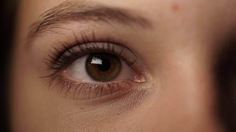 What To Expect During Dark Circles Treatment What To Expect During Dark Circles Treatment by MuhammadAhmad
