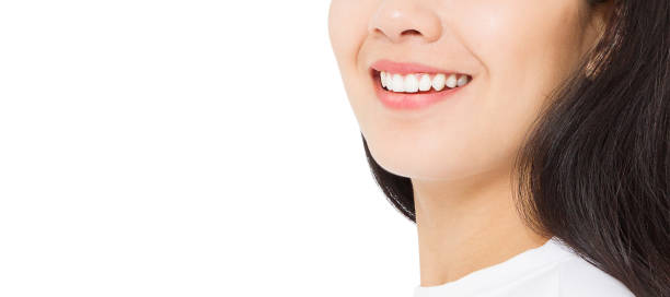Is Teeth Whitening Effective For Yellow Teeth? by Enfieldabudhabi