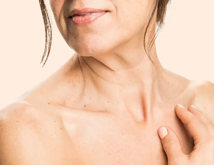 What Is The Most Effective Option For Treating Neck Wrinkles? by dynamicaesthetic