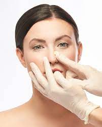 Rhinoplasty Surgery In Riyadh: Enhancing Profile And Self-Esteem by enfieldroyalsaudi050