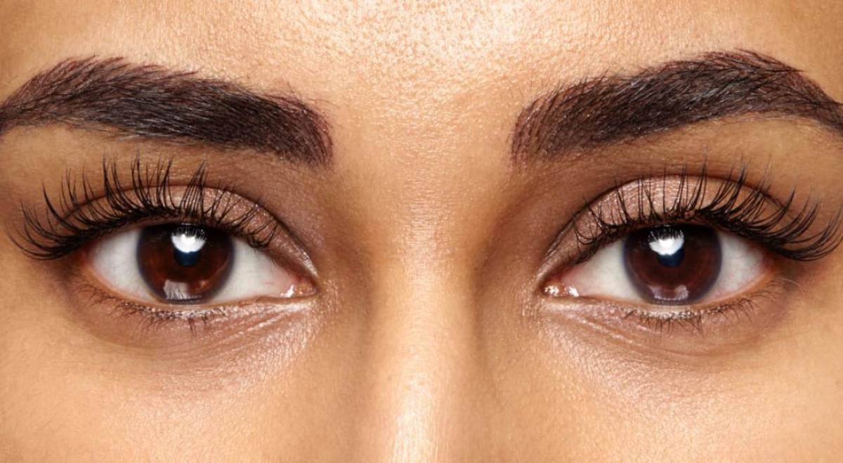 Can Eyelash Transplant Help Sparse Eyelashes? by fatimadynamic
