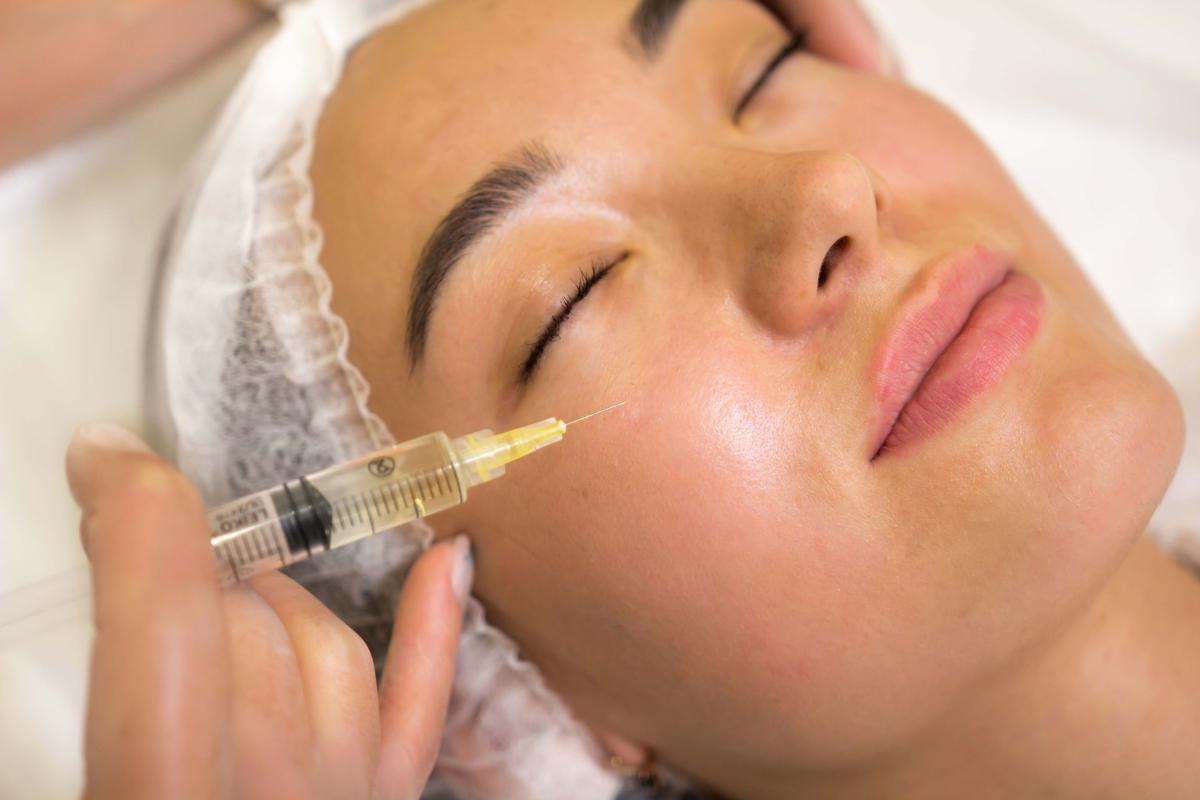 Is Volite Filler Treatment Worth It For Dry Skin? by Dynamicclinic12