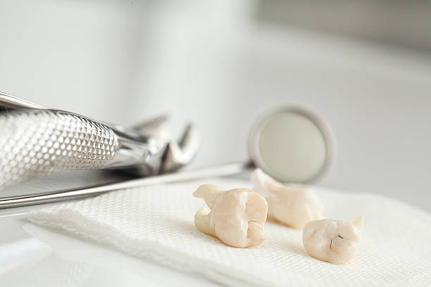 Preparing For Wisdom Teeth Extraction: What You Should Know Preparing For Wisdom Teeth Extraction: What You Should Know by Bridgeport Aesthetic Dentistry