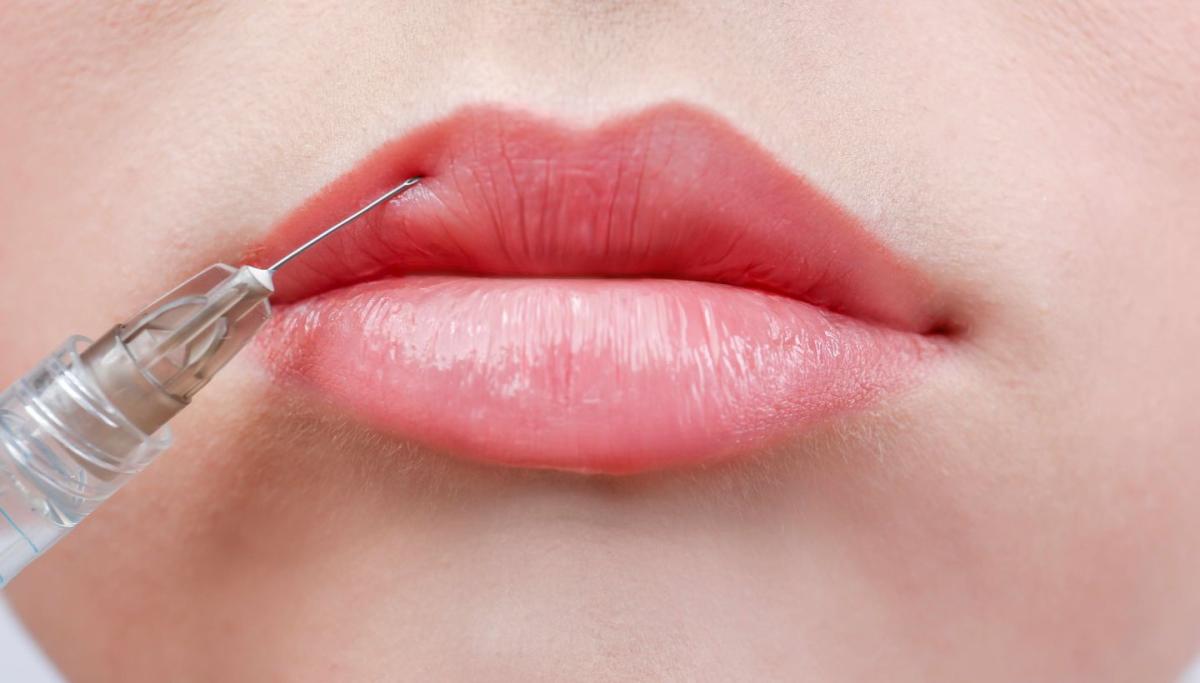 How Do Lip Fillers Differ From Botox Injections? by dynamicaesthetic