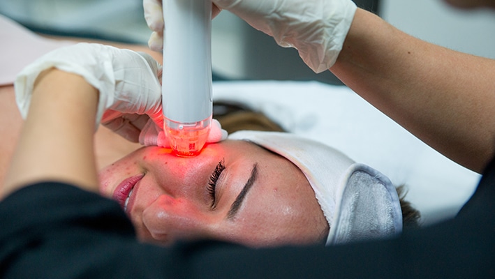 How Safe Is Radio Frequency For Acne Scars? by cdynmic
