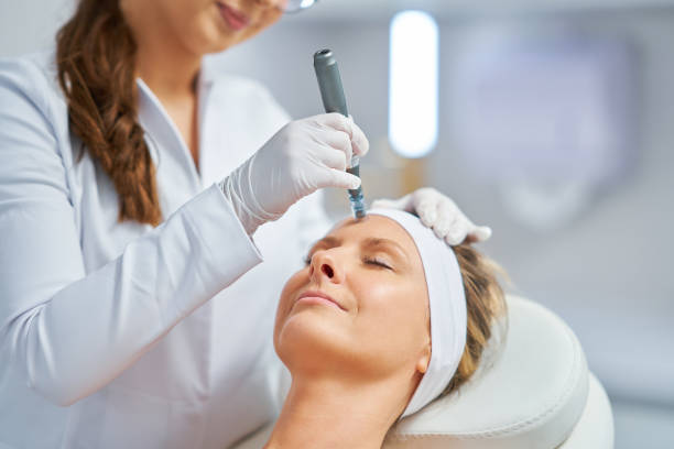 Is RF Micro Needling Painful Or Comfortable Overall? by Enfieldabudhabi