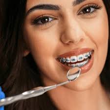 Which Clinic Offers Advanced Laser Dentistry In Islamabad? by glamorous