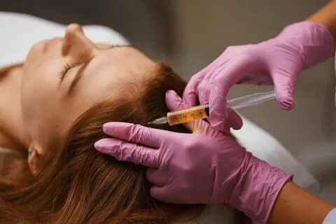 Is PRP Hair Treatment Suitable For All Hair Types? Is PRP Hair Treatment Suitable For All Hair Types? by MuhammadAhmad