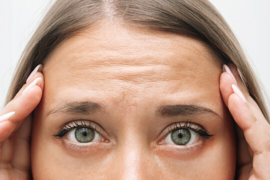 Are Forehead Lifts Effective In Creating A Smooth Upper Face? by Dynamic Life Clinics