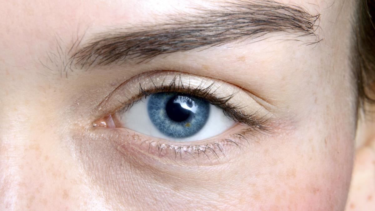 How To Prepare For A Dark Circles Treatment Session? How To Prepare For A Dark Circles Treatment Session? by MuhammadAhmad