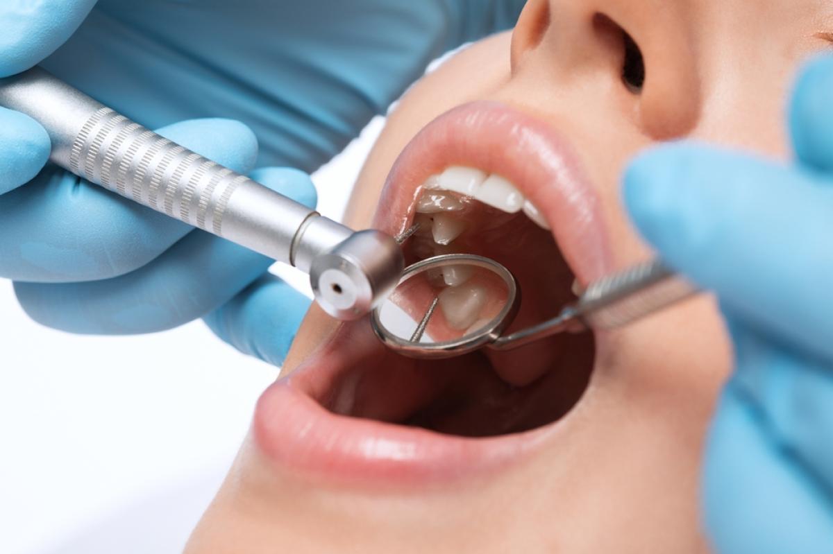 What Happens If You Don’t Get A Cavity Filled? by Aesthethic Clinic