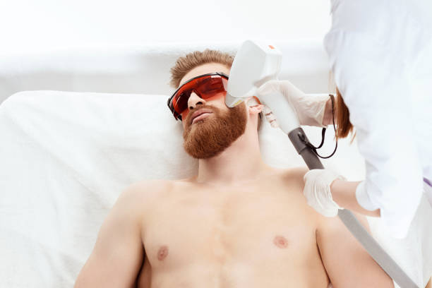 Who Is The Right Candidate For Beard Laser Hair Removal ? by Enfieldabudhabi