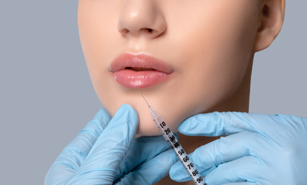 How Much Juvederm Filler Is Usually Required For Facial Treatments? by cdynmic