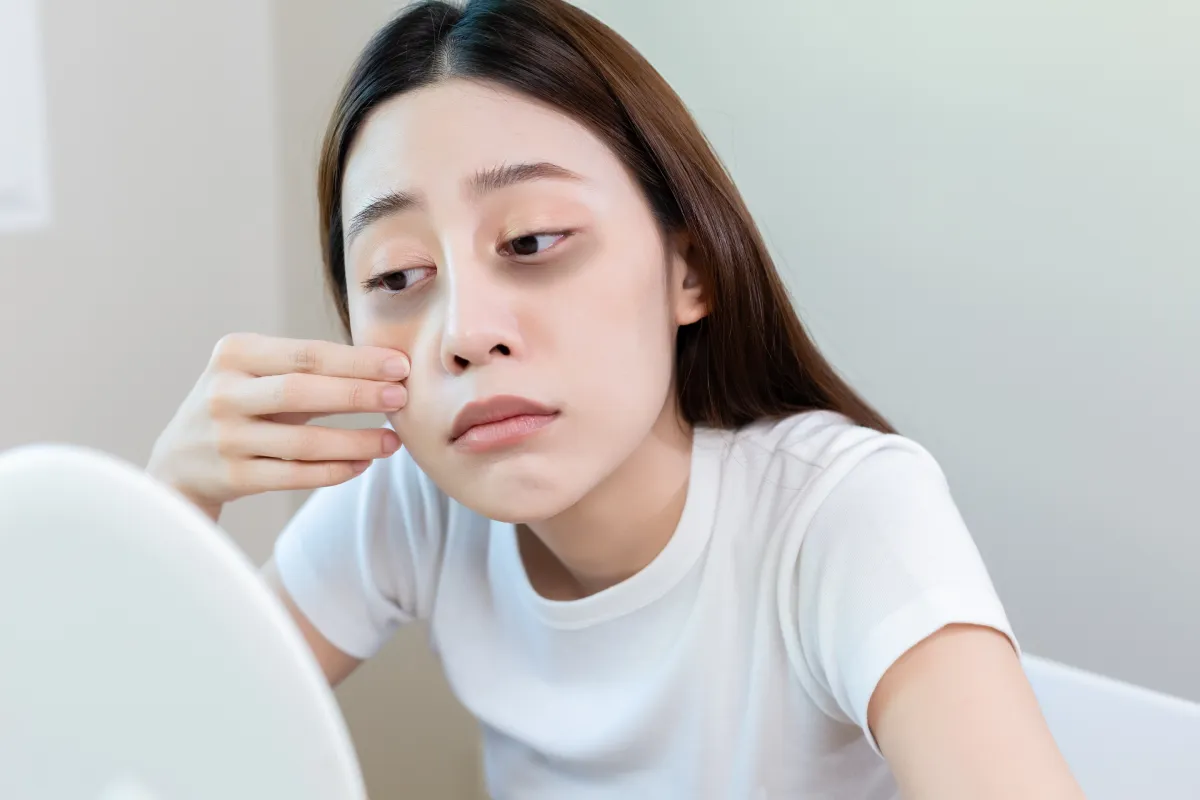 Does Stress Contribute To Dark Circles Formation? Does Stress Contribute To Dark Circles Formation? by MuhammadAhmad