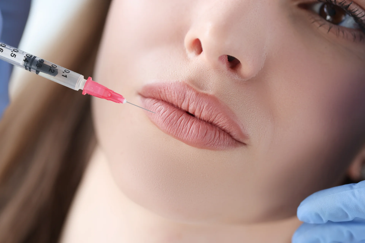 Can Volbella Deliver Natural-Looking Lip Hydration And Smoothness? by dynamicaesthetic