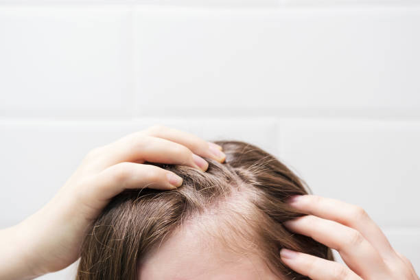 How Long Do Treatments Take For Hair Loss & Nail Disorders ? by Enfieldabudhabi