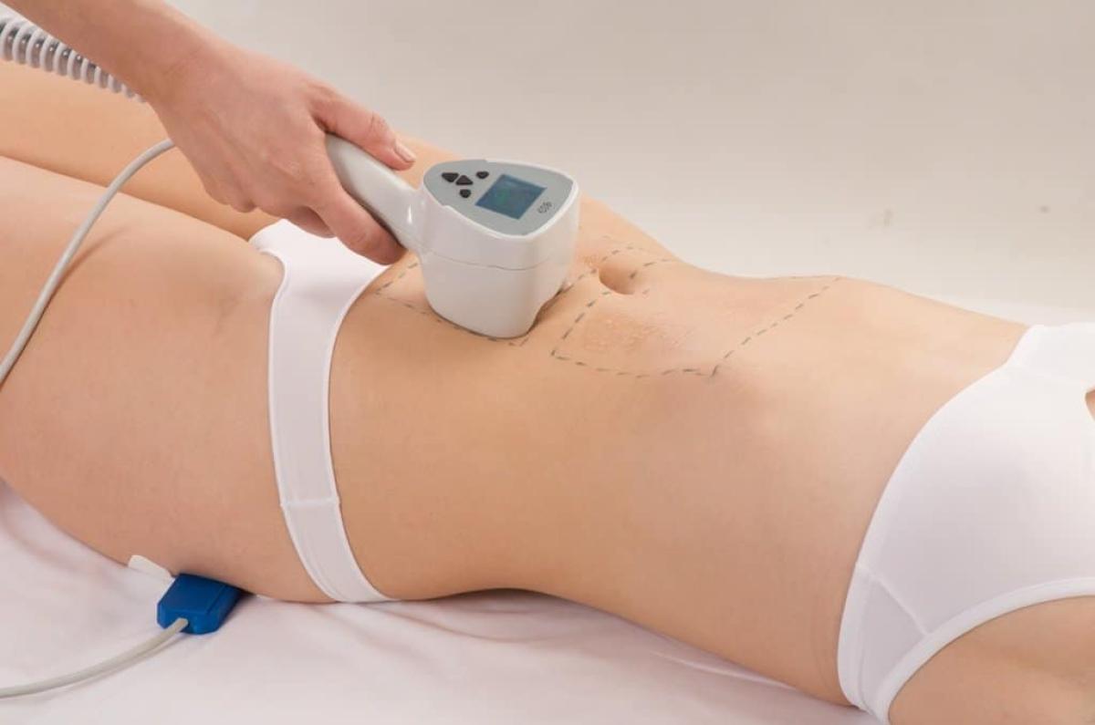 How Is The Best Exilis Treatment Different? How Is The Best Exilis Treatment Different? by eirhakhan
