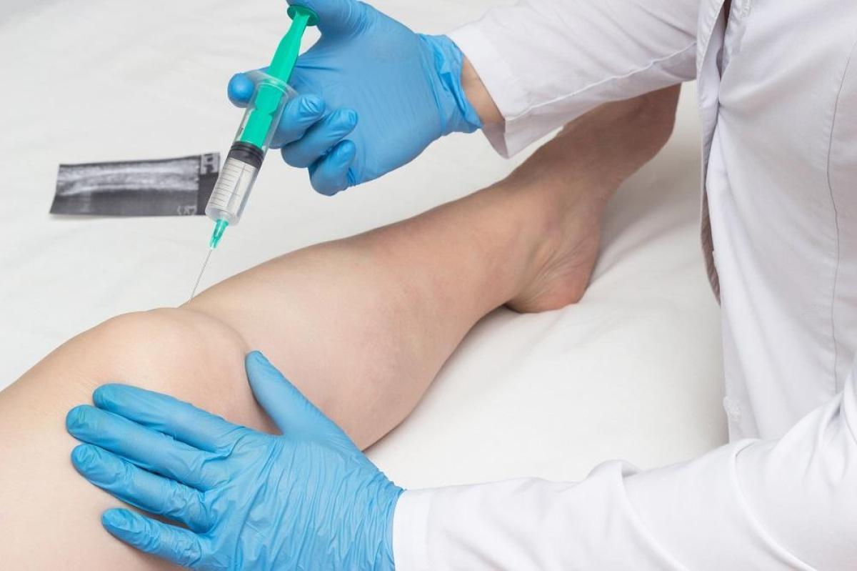 Does Stem Cell Therapy Require Surgery? Does Stem Cell Therapy Require Surgery? by eirhakhan