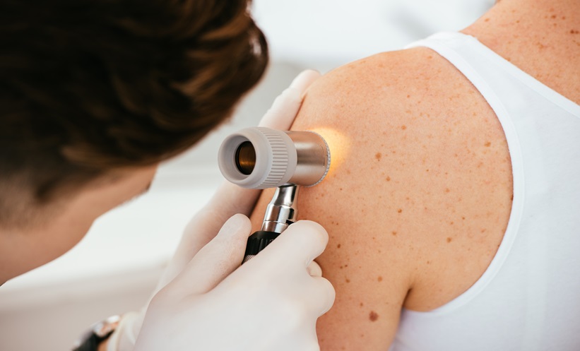 How Precise Are Dermoscopy Results In Detecting Skin Concerns? by dynamicaesthetic