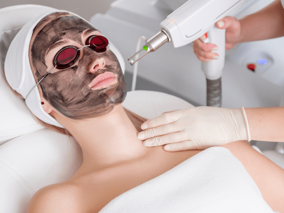 Achieve Glowing Skin With Professional Laser Carbon Peel by Dynamic Life Clinic