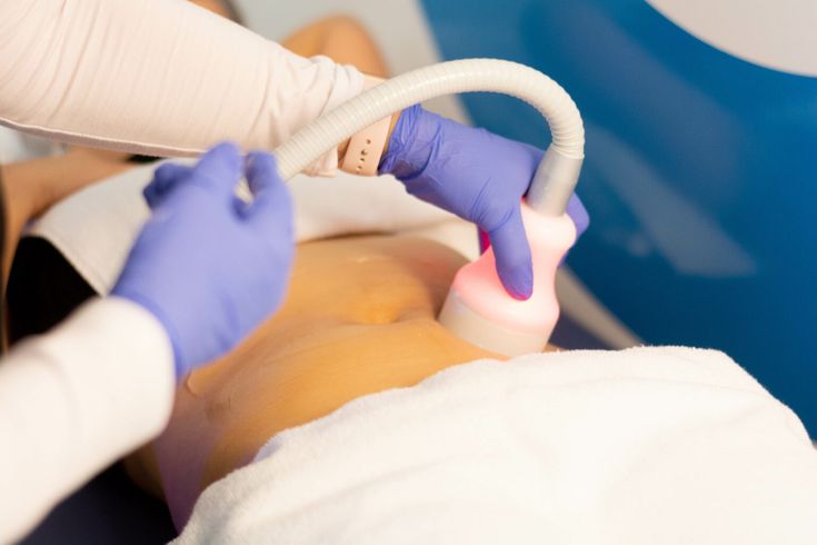 Can Sculptra Fillers Stimulate Collagen Growth Naturally? by Dynamicclinic12