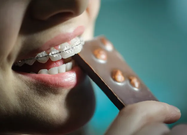 eating foods braces  avoid certain foods with braces