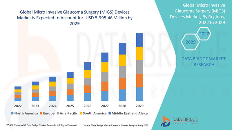 Why Are MIGS Devices Becoming The Preferred Choice For Glaucoma Treatment Globally? by kshdbmrin