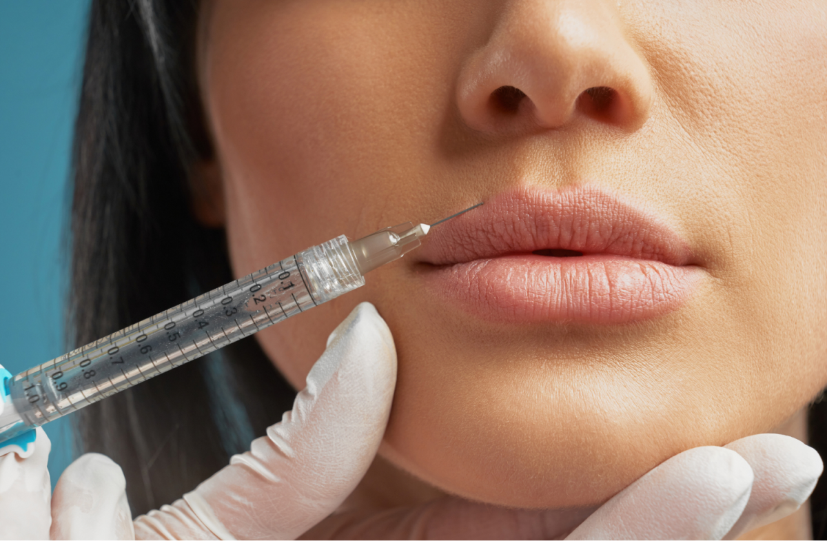 How Does A Botox Lip Flip Interact With Facial Muscles? by Ahmad Hassan
