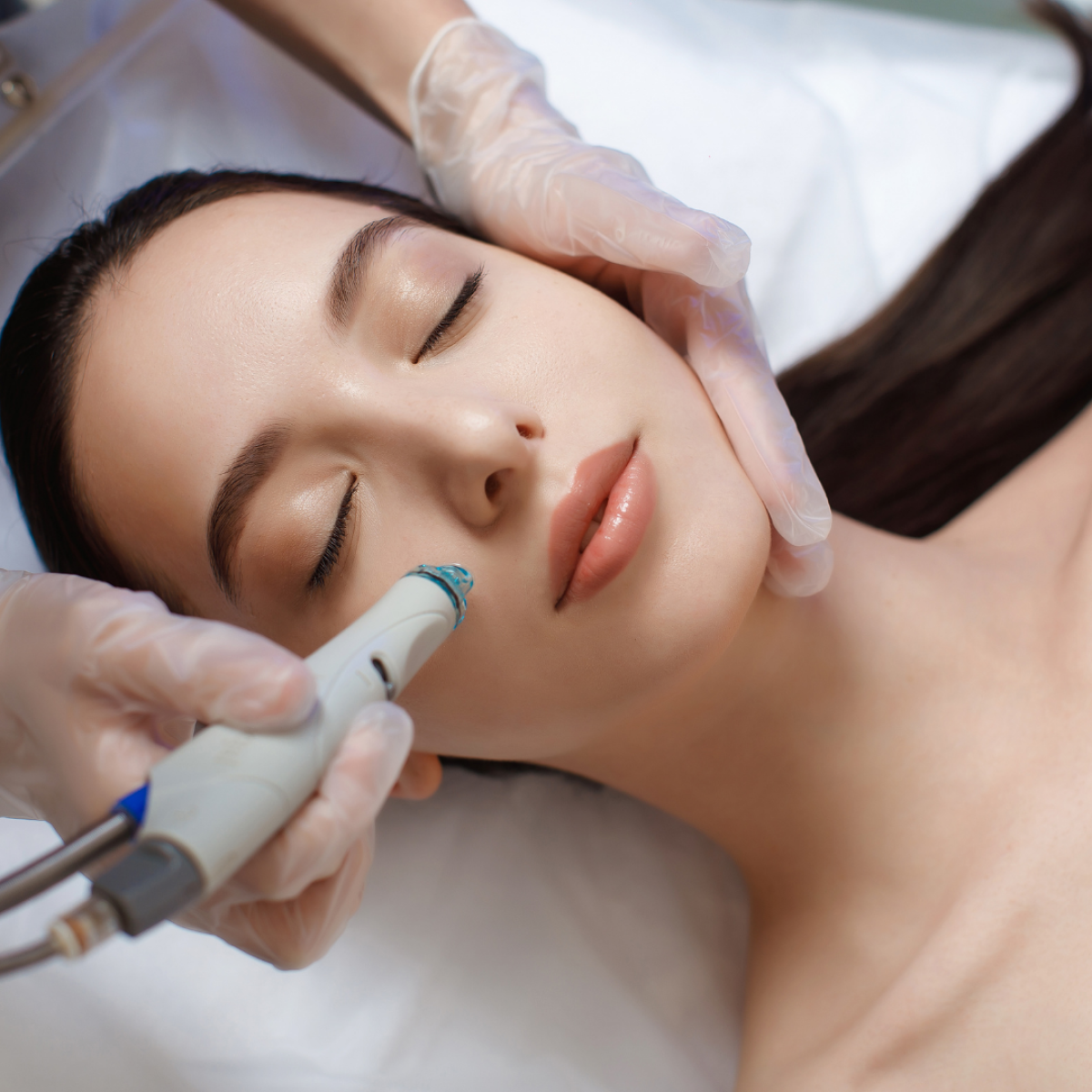 Is Hydrafacial A Safe Option For Delicate Or Sensitive Skin? by dynamicaesthetic