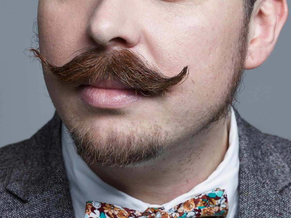 Can A Mustache Transplant Improve Self-Esteem? by fatimadynamic