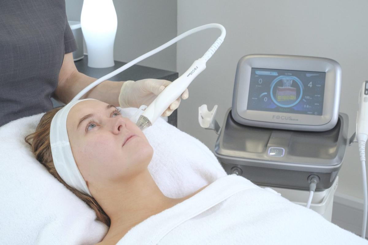 Does RF Microneedling Work On Pitted Acne Scars? by Dynamic Life Clinics
