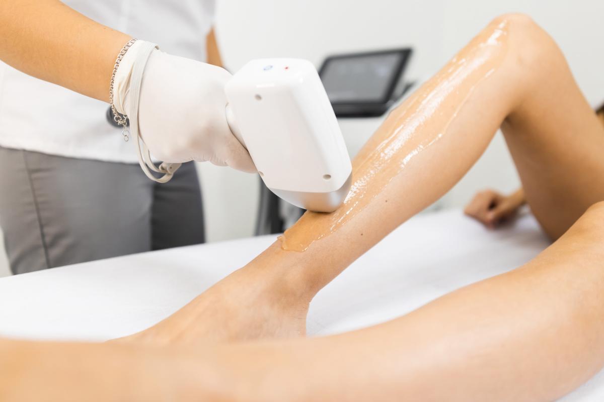 What Are Laser Hair Removal Benefits? What Are Laser Hair Removal Benefits? by eirhakhan