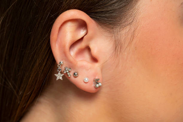 Does Ear Piercing Help Prevent Keloid Formation? by Enfieldabudhabi